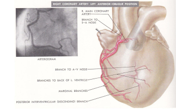 coronary angiography